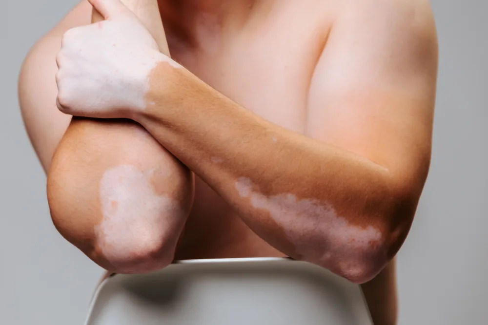 Guardoli Dermatology Nice • Un traitement profond pour plus de stabilité