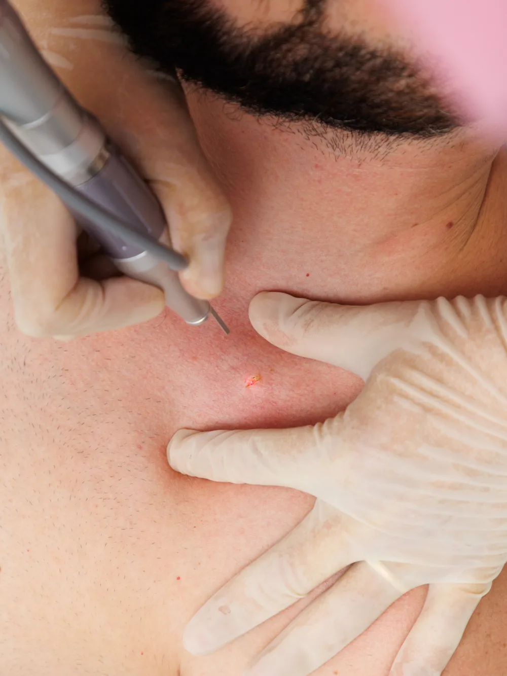 Guardoli Dermatology Nice • Corps