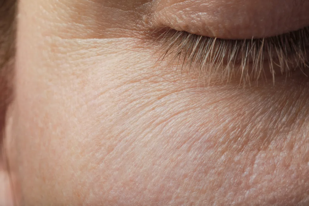 Guardoli Dermatology Nice • Contour des yeux