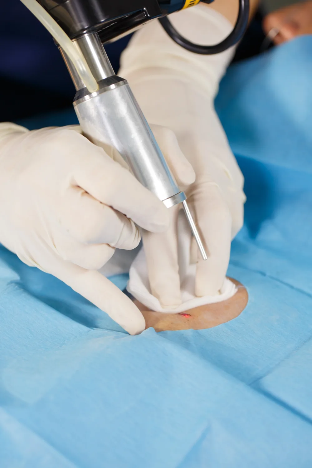 Guardoli Dermatology Nice • Du diagnostic à la prise en charge