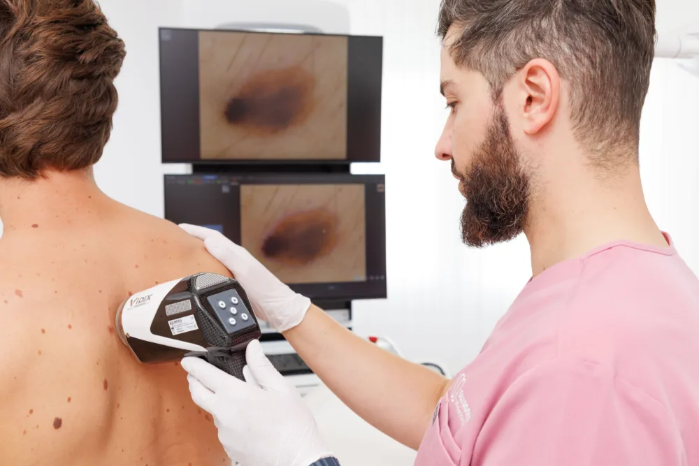 Guardoli Dermatology Nice • Surveillance des grains de beauté