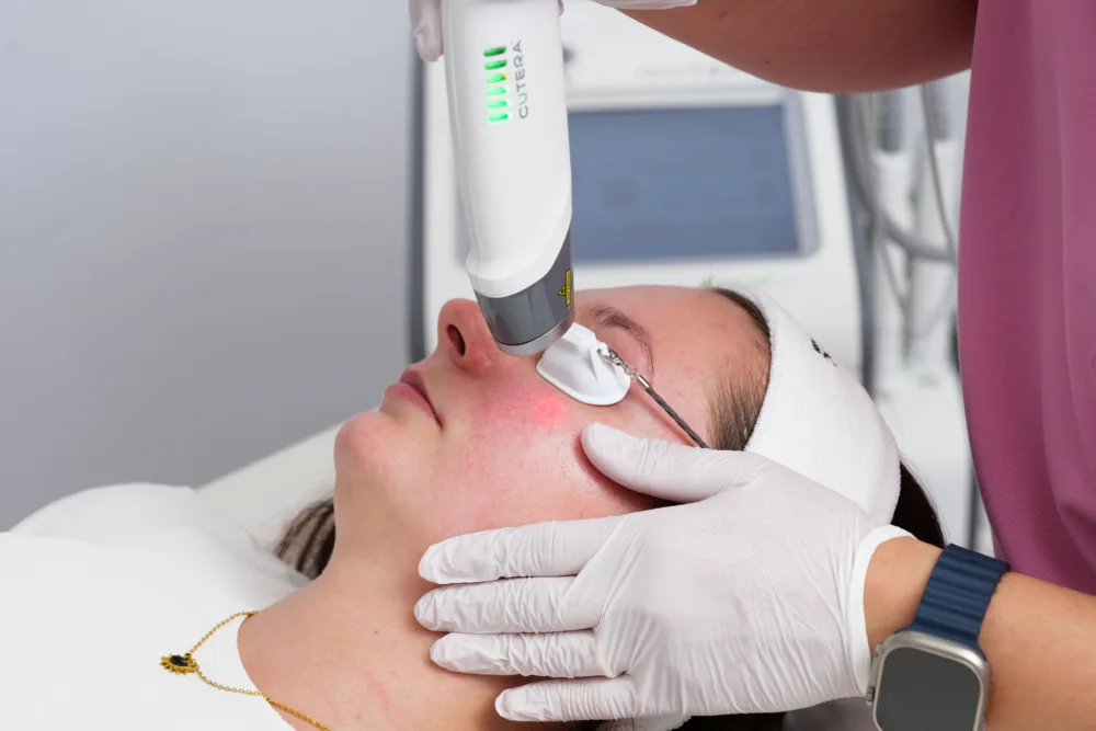 Guardoli Dermatology Nice • Joues
