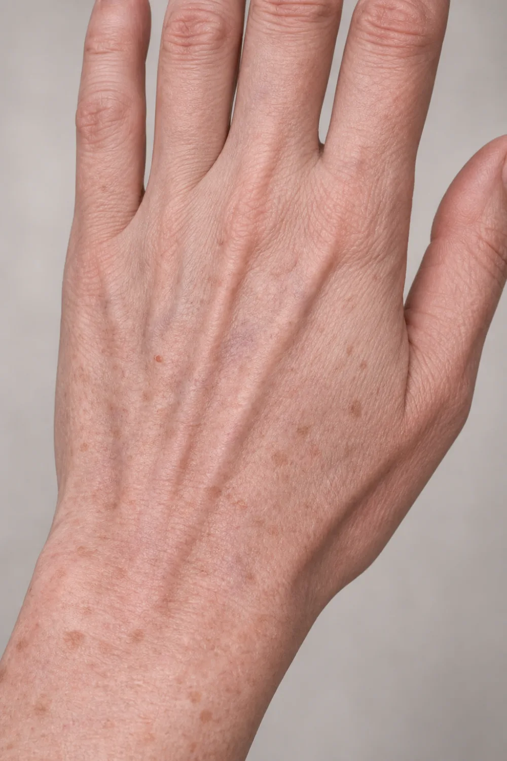 Guardoli Dermatology Nice • Mains