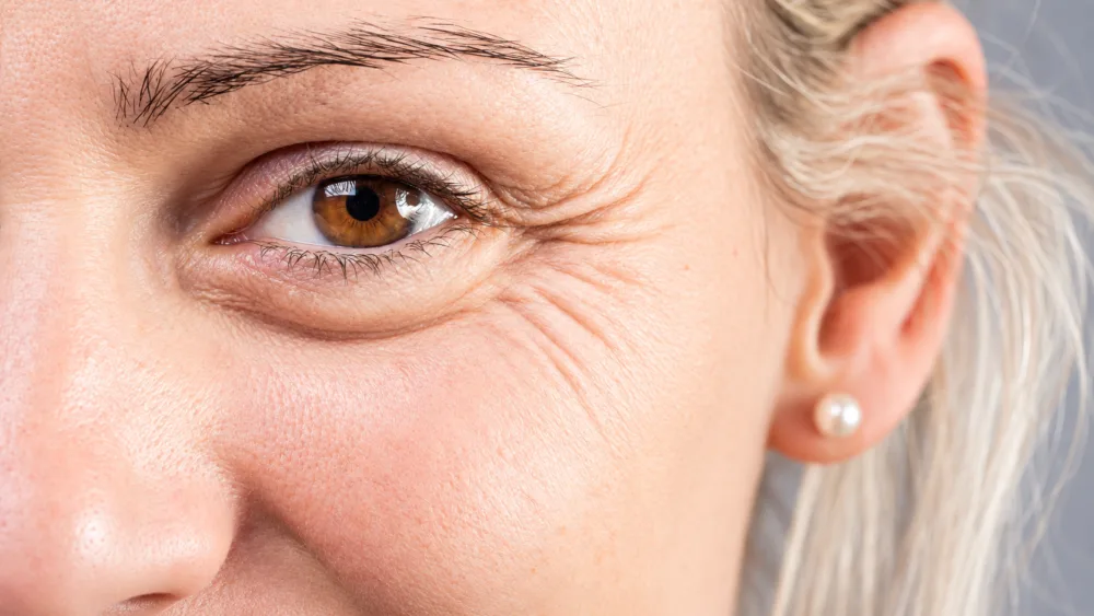 Guardoli Dermatology Nice • Contours des yeux